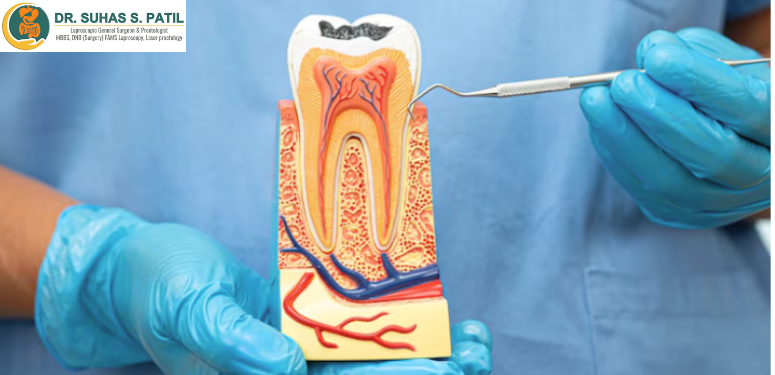 Piles Doctor in Pimpri Chinchwad | Dr. Suhas S. Patil