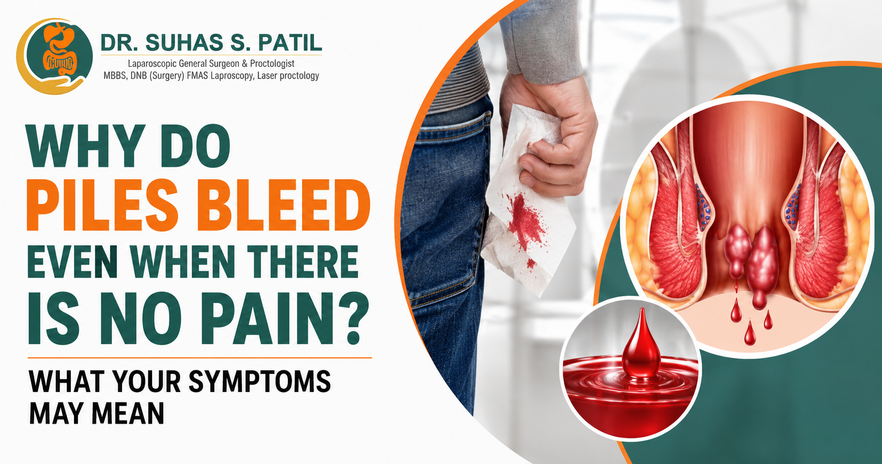 Medical infographic explaining why piles can bleed without pain, featuring hemorrhoid bleeding and Dr. Suhas S. Patil.