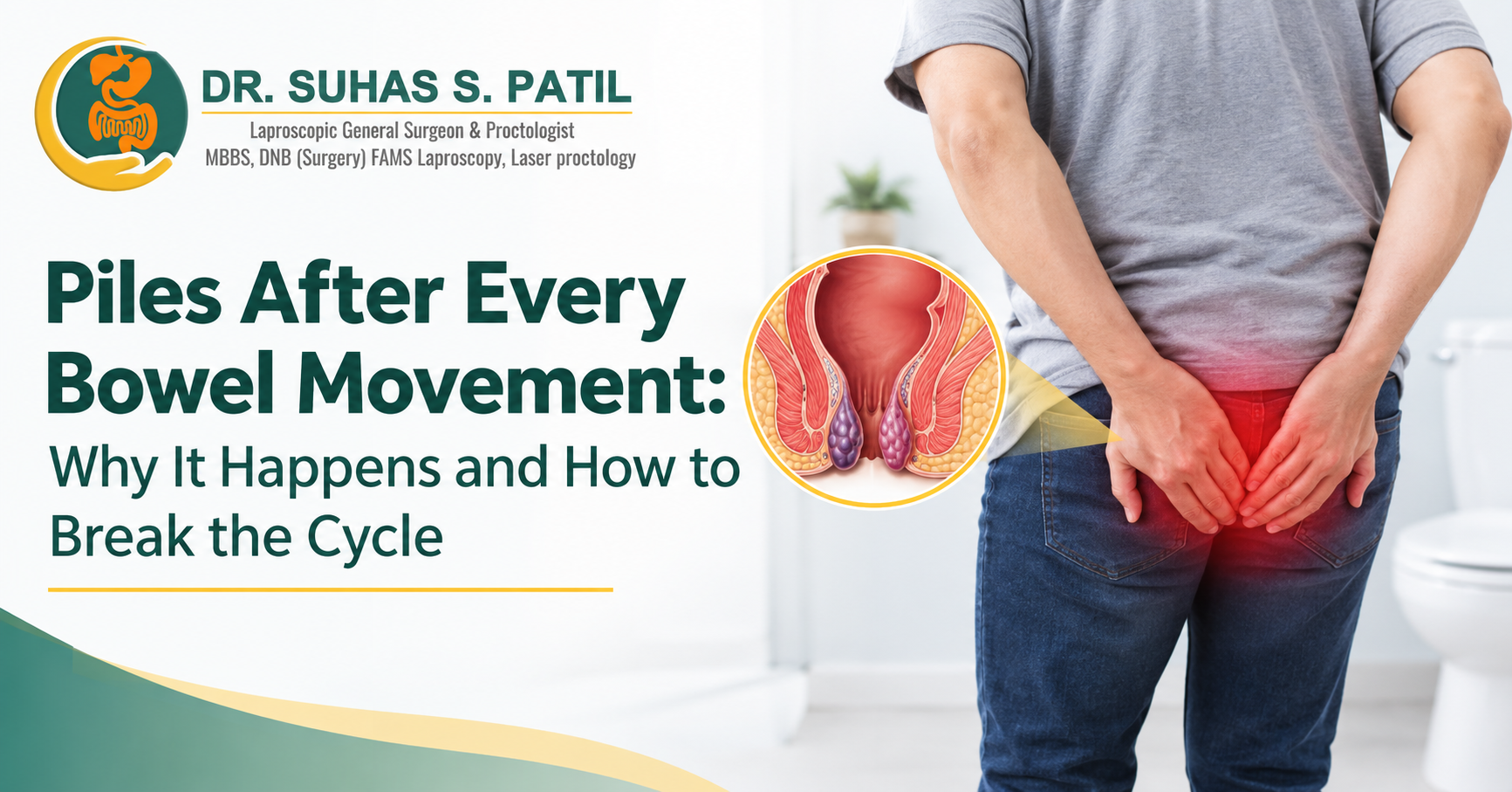 Piles after every bowel movement showing hemorrhoid symptoms and causes of recurring discomfort